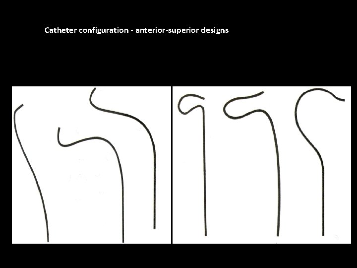 Catheter configuration - anterior-superior designs 