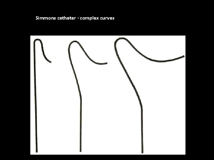 Simmons catheter - complex curves 
