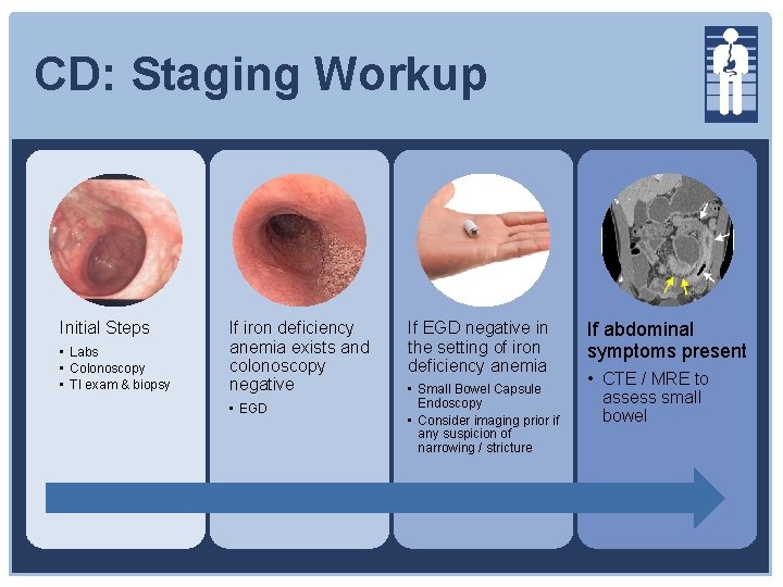 CD: Staging Workup Initial Steps • Labs • Colonoscopy • TI exam & biopsy