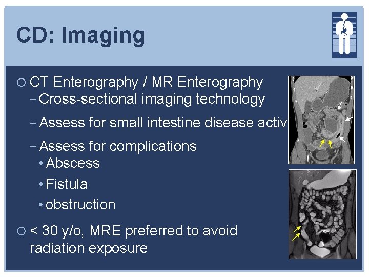 CD: Imaging CT Enterography / MR Enterography − Cross-sectional imaging technology − Assess for