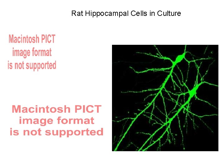 Rat Hippocampal Cells in Culture 