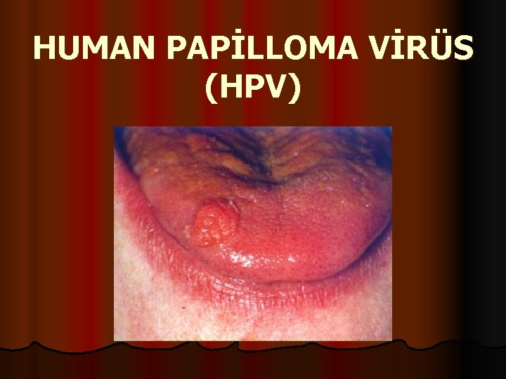 HUMAN PAPİLLOMA VİRÜS (HPV) 