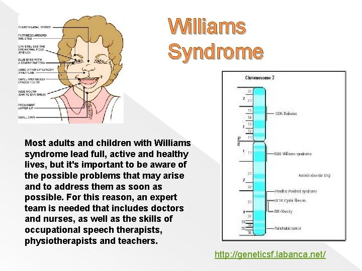 Williams Syndrome Most adults and children with Williams syndrome lead full, active and healthy