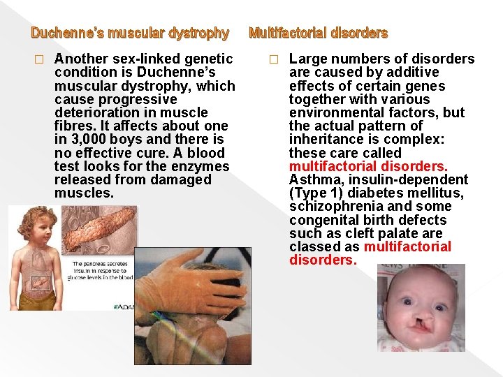 Duchenne’s muscular dystrophy Multifactorial disorders � Another sex-linked genetic condition is Duchenne’s muscular dystrophy,