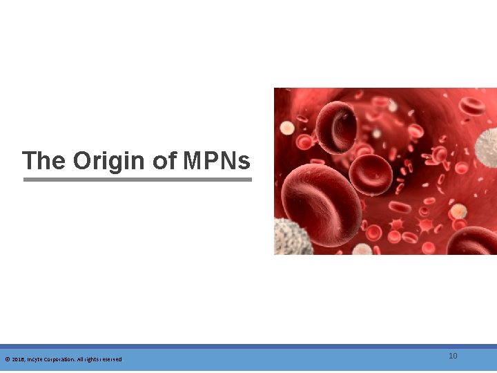 The Origin of MPNs © 2016, Incyte Corporation. All rights reserved. 10 