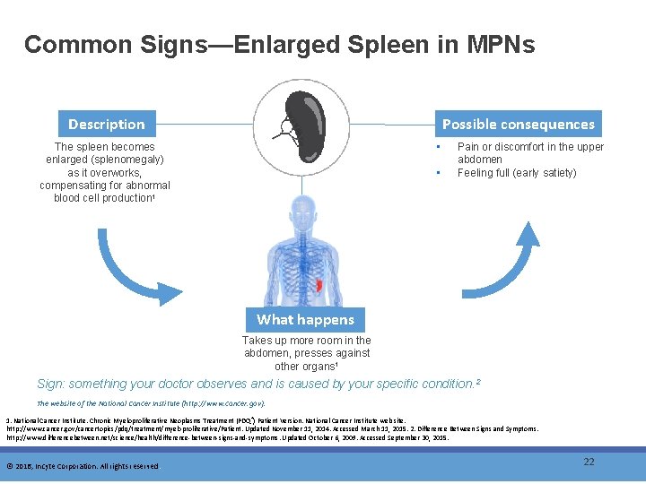Common Signs—Enlarged Spleen in MPNs Description Possible consequences • The spleen becomes enlarged (splenomegaly)