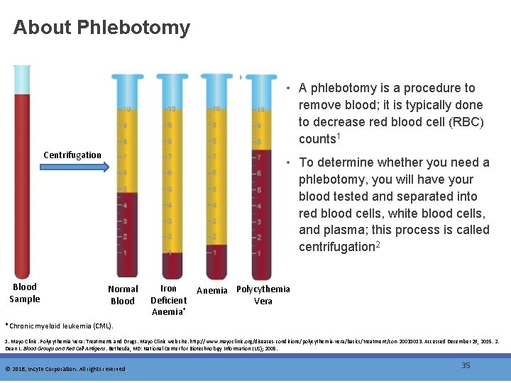 About Phlebotomy • A phlebotomy is a procedure to remove blood; it is typically