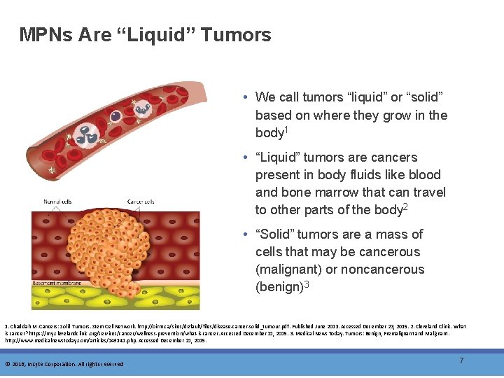 MPNs Are “Liquid” Tumors • We call tumors “liquid” or “solid” based on where