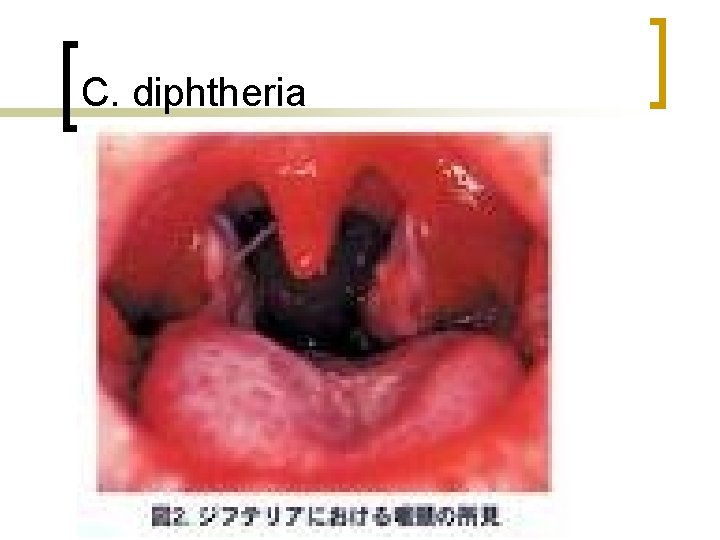 C. diphtheria 