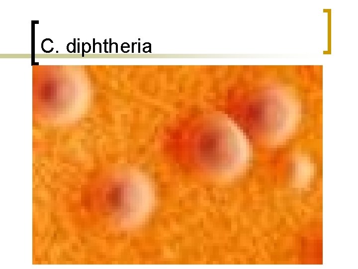 C. diphtheria 