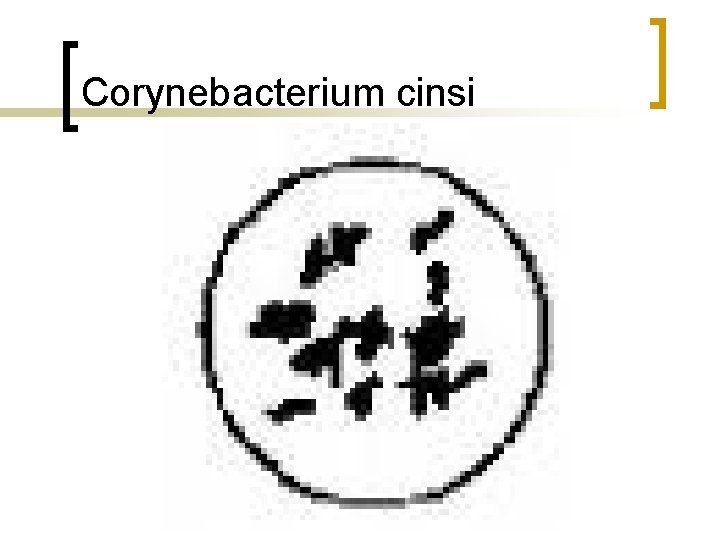 Corynebacterium cinsi 