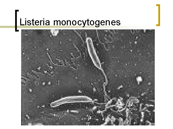 Listeria monocytogenes 