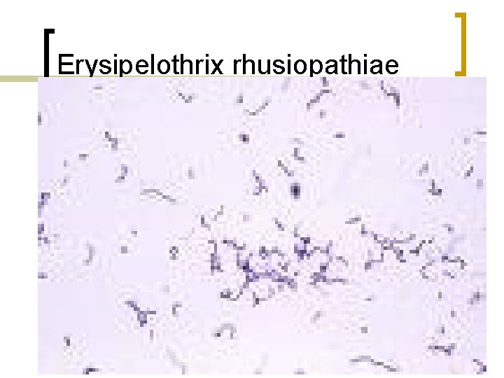 Erysipelothrix rhusiopathiae 
