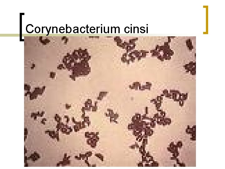 Corynebacterium cinsi 