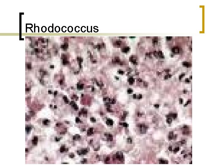 Rhodococcus 