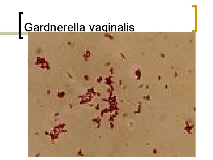 Gardnerella vaginalis 