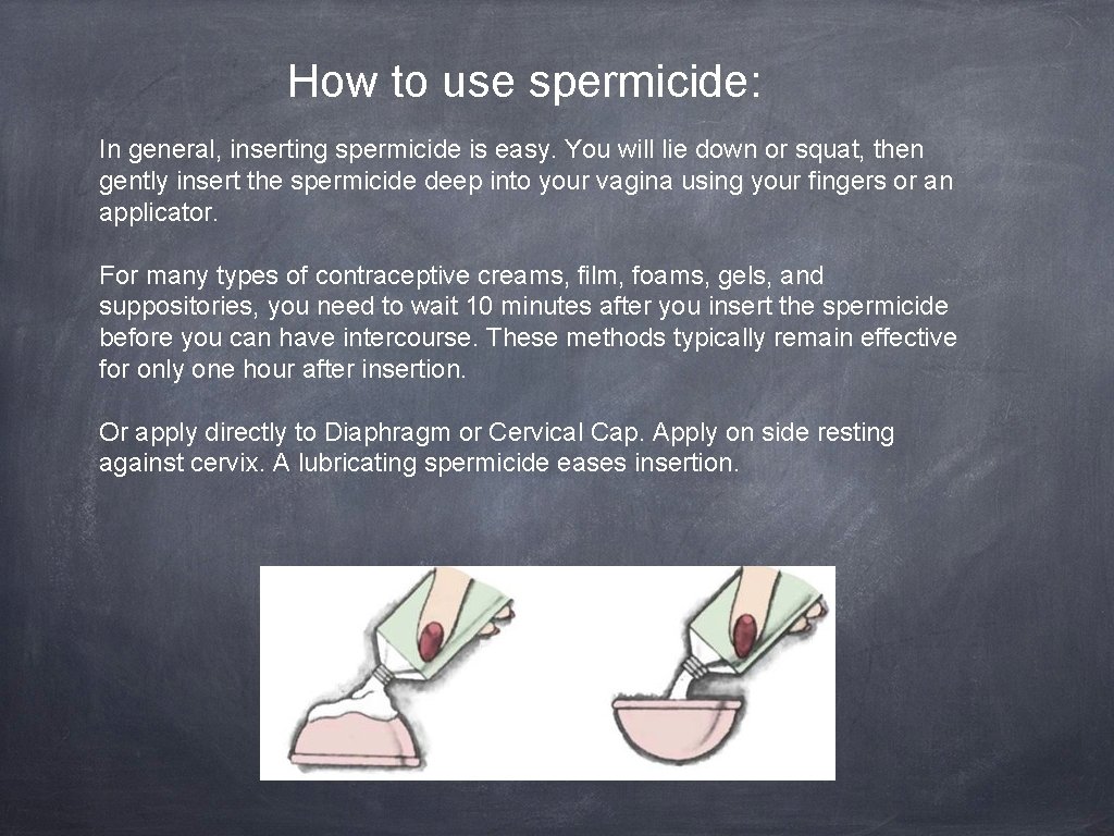 How to use spermicide: In general, inserting spermicide is easy. You will lie down