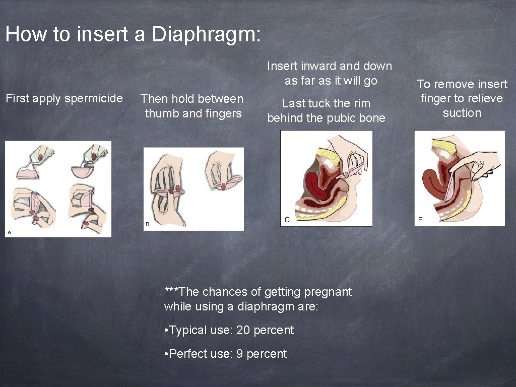How to insert a Diaphragm: Insert inward and down as far as it will