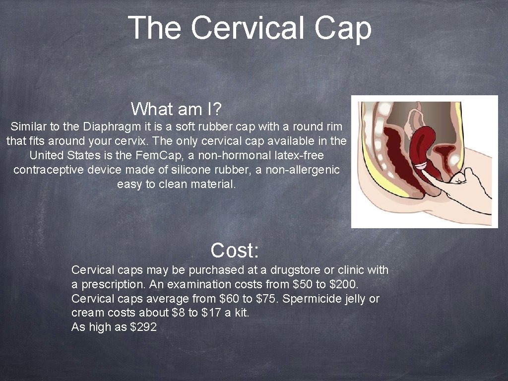 The Cervical Cap What am I? Similar to the Diaphragm it is a soft