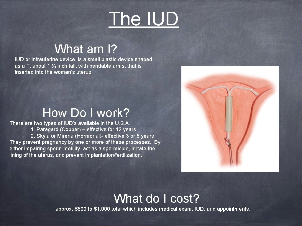 The IUD What am I? IUD or intrauterine device, is a small plastic device