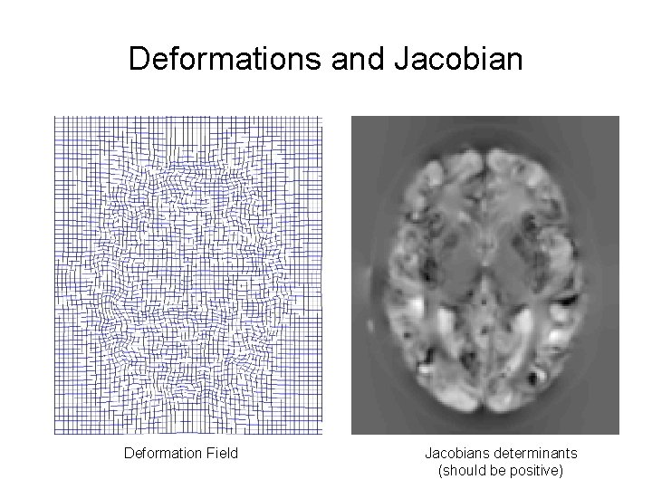 Deformations and Jacobian Deformation Field Jacobians determinants (should be positive) 