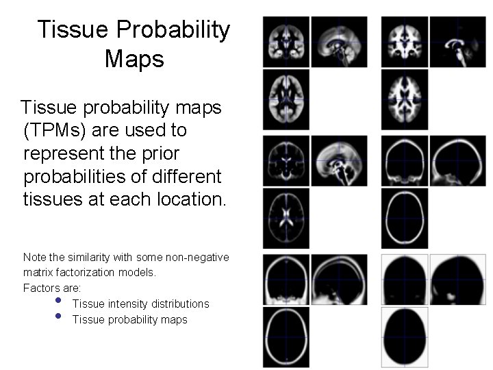 Tissue Probability Maps Tissue probability maps (TPMs) are used to represent the prior probabilities