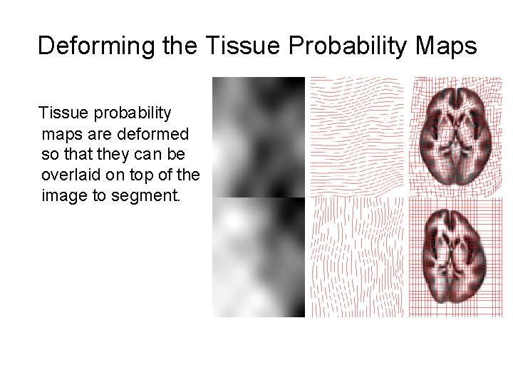 Deforming the Tissue Probability Maps Tissue probability maps are deformed so that they can