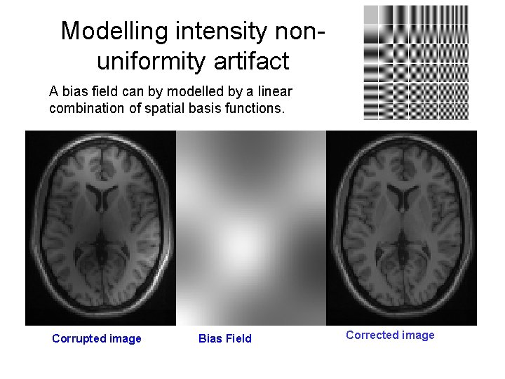 Modelling intensity nonuniformity artifact A bias field can by modelled by a linear combination