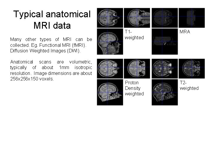 Typical anatomical MRI data Many other types of MRI can be collected. Eg. Functional