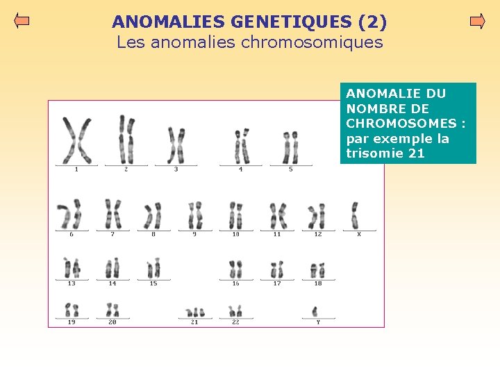 ANOMALIES GENETIQUES (2) Les anomalies chromosomiques ANOMALIE DU NOMBRE DE CHROMOSOMES : par exemple