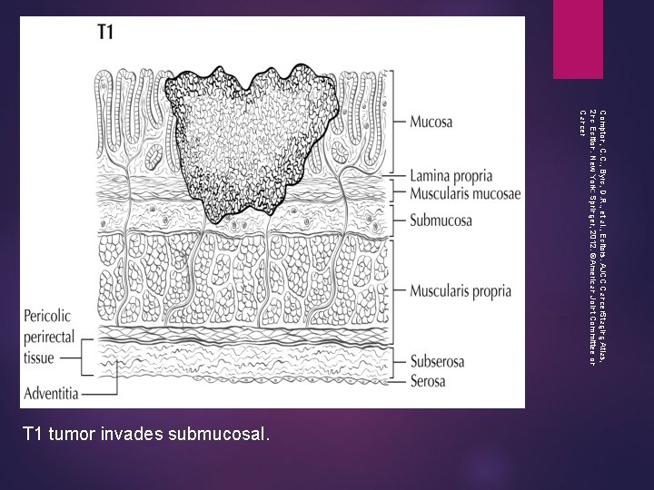 Compton, C. C. , Byrd, D. R. , et al. , Editors. AJCC Cancer.
