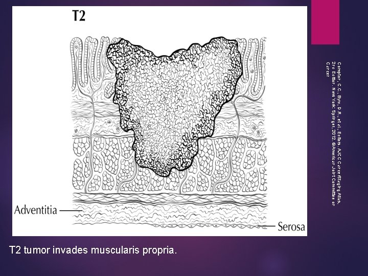 Compton, C. C. , Byrd, D. R. , et al. , Editors. AJCC Cancer.