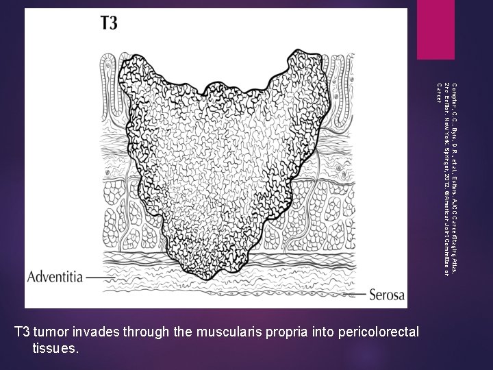 Compton, C. C. , Byrd, D. R. , et al. , Editors. AJCC Cancer.