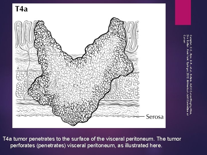 Compton, C. C. , Byrd, D. R. , et al. , Editors. AJCC Cancer.