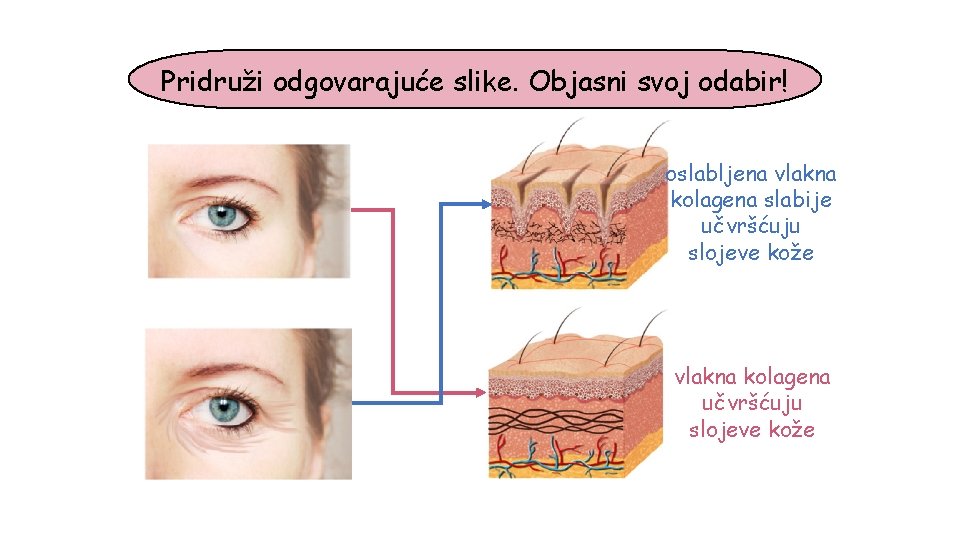 Pridruži odgovarajuće slike. Objasni svoj odabir! oslabljena vlakna kolagena slabije učvršćuju slojeve kože vlakna