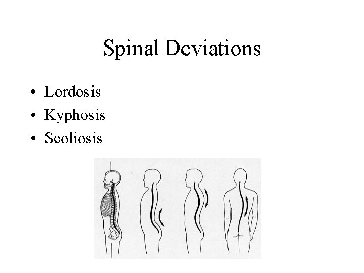 Spinal Deviations • Lordosis • Kyphosis • Scoliosis 