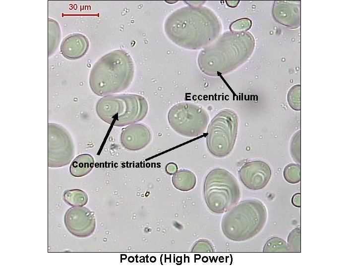 Eccentric hilum Concentric striations Potato (High Power) 