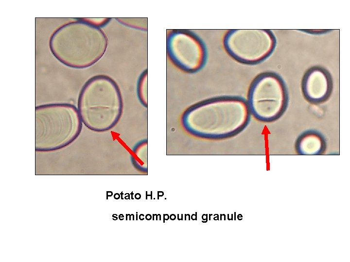 Potato H. P. semicompound granule 