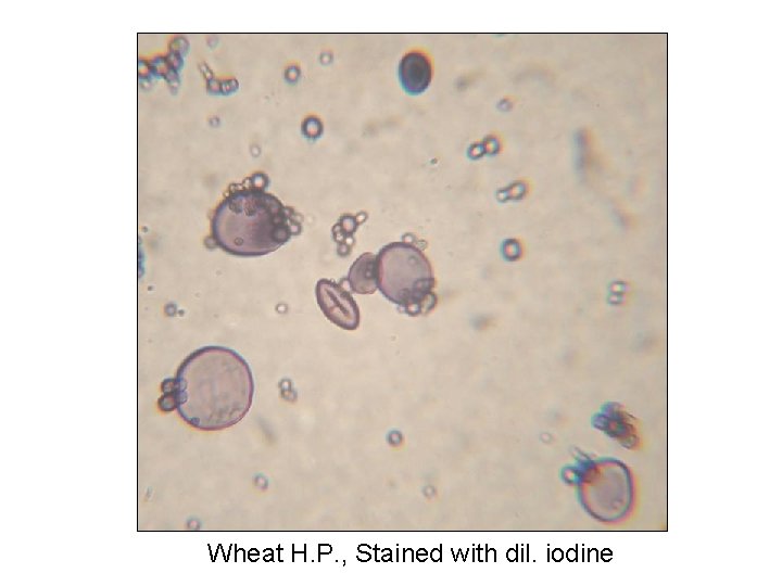 Wheat H. P. , Stained with dil. iodine 