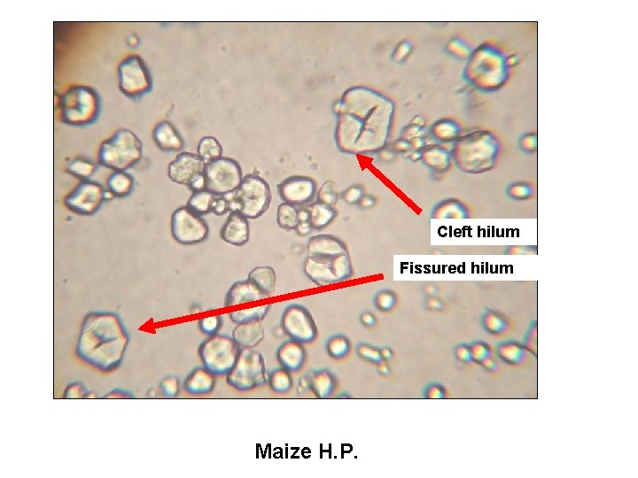 Cleft hilum Fissured hilum Maize H. P. 