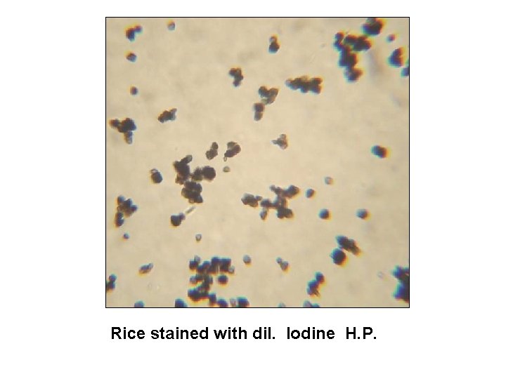 Rice stained with dil. Iodine H. P. 