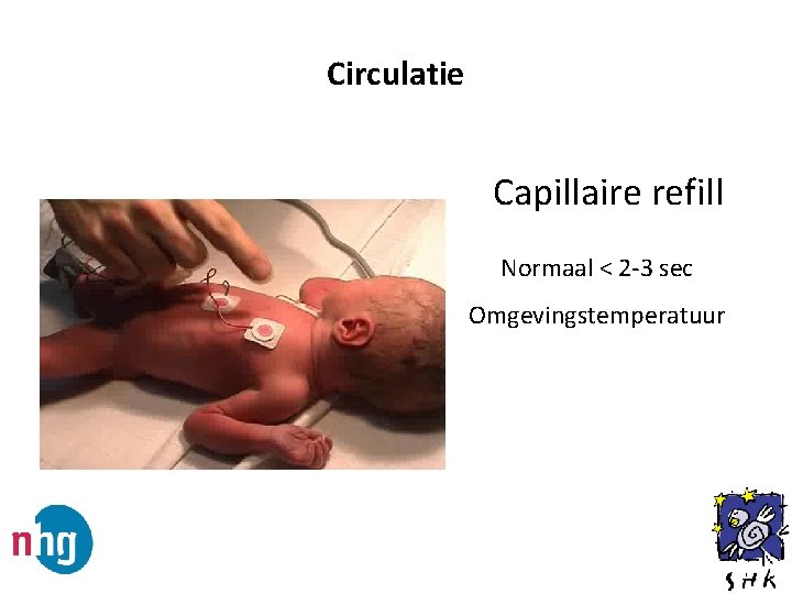 Circulatie Capillaire refill Normaal < 2 -3 sec Omgevingstemperatuur 