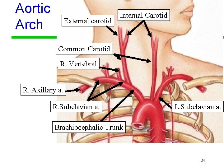Aortic Arch External carotid Internal Carotid Common Carotid R. Vertebral R. Axillary a. R.
