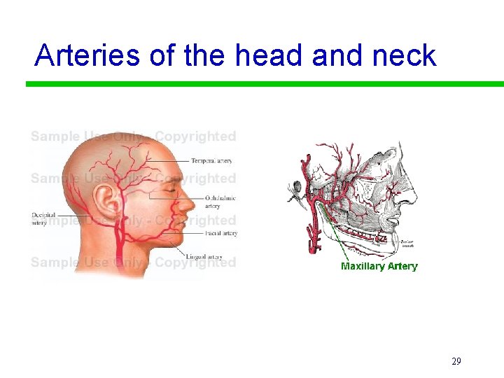Arteries of the head and neck 29 