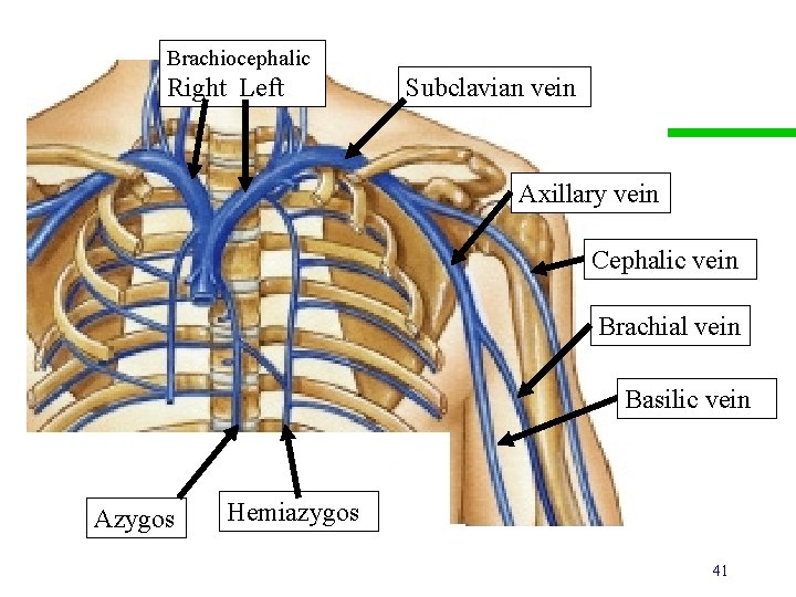 Brachiocephalic Right Left Subclavian vein Axillary vein Cephalic vein Brachial vein Basilic vein Azygos