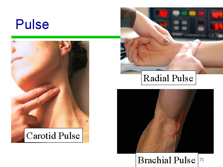 Pulse Radial Pulse Carotid Pulse Brachial Pulse 71 
