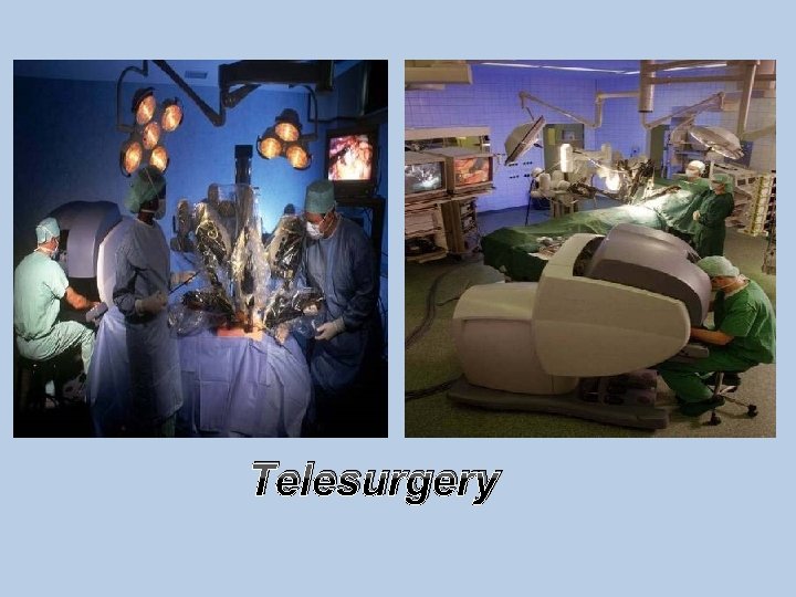 Telesurgery 