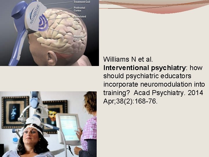 Williams N et al. Interventional psychiatry: how should psychiatric educators incorporate neuromodulation into training?