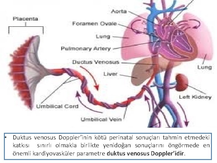  • Duktus venosus Doppler’inin kötü perinatal sonuçları tahmin etmedeki katkısı sınırlı olmakla birlikte