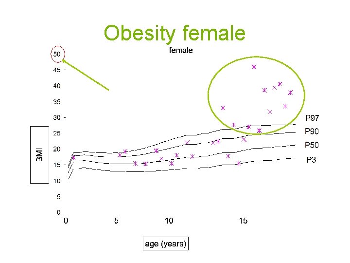 Obesity female 